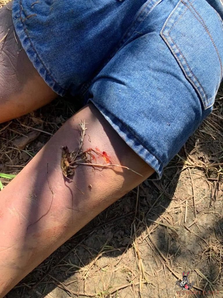 18-Year-Old Girl Found Stabbed to Death by Lover