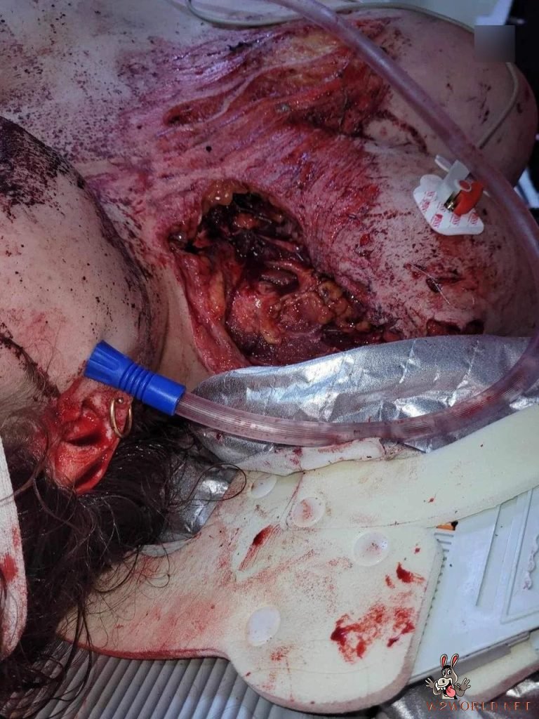 Young woman dying after accident