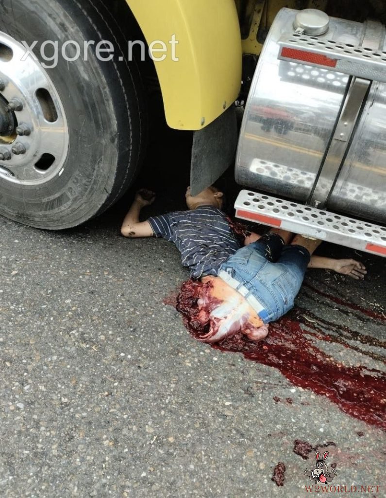 Colombia: Young Man Severed in Half in Horrific Truck Accident