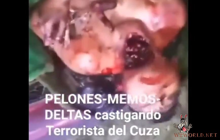 Photos of victims dismembered or beheaded in Mexico's gang wars