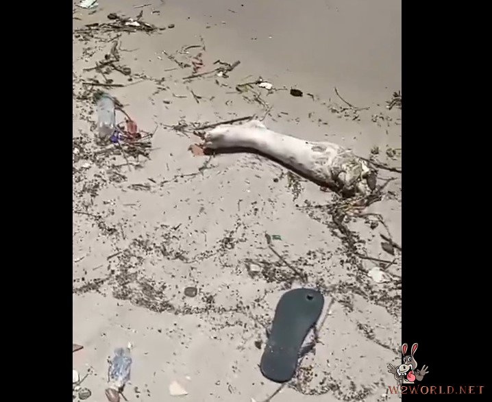 Severed leg discovered on beach