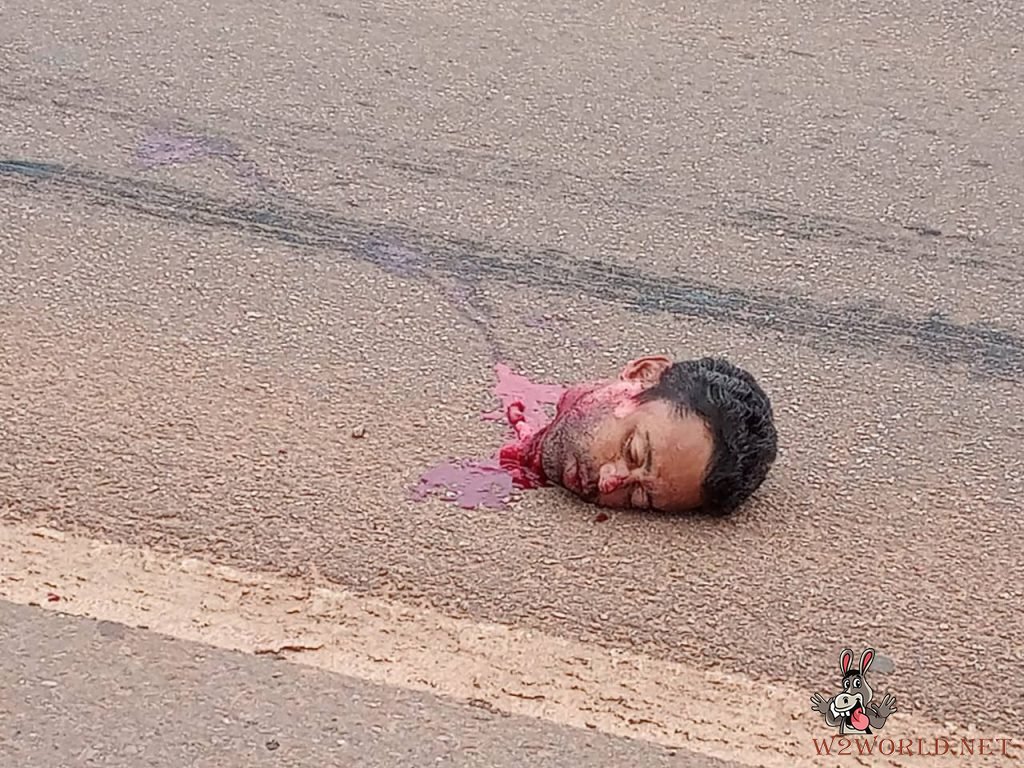 Man accidentally cut into pieces