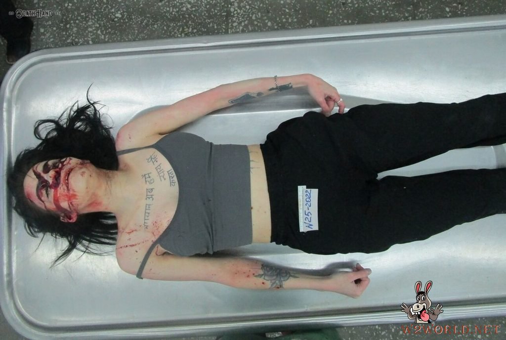 Young woman's autopsy