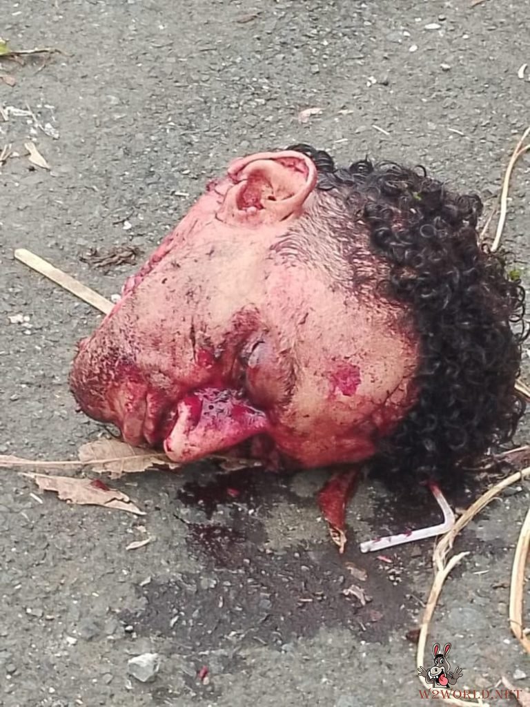Discovery of severed head and body parts on road