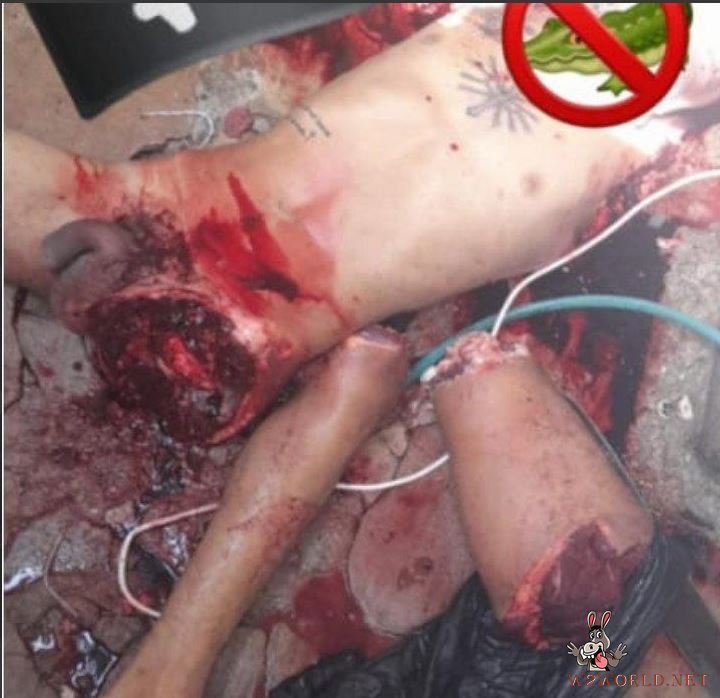 Young man dismembered in Barranquilla