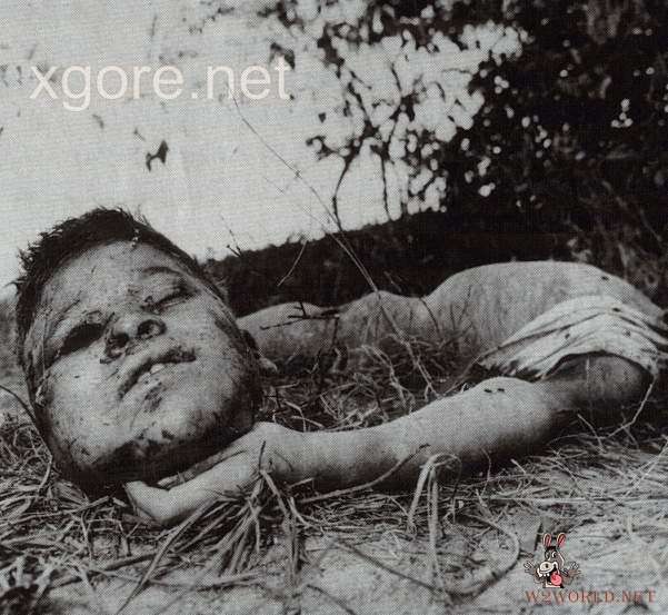 Classic Decapitation Cases: A Gruesome Examination
