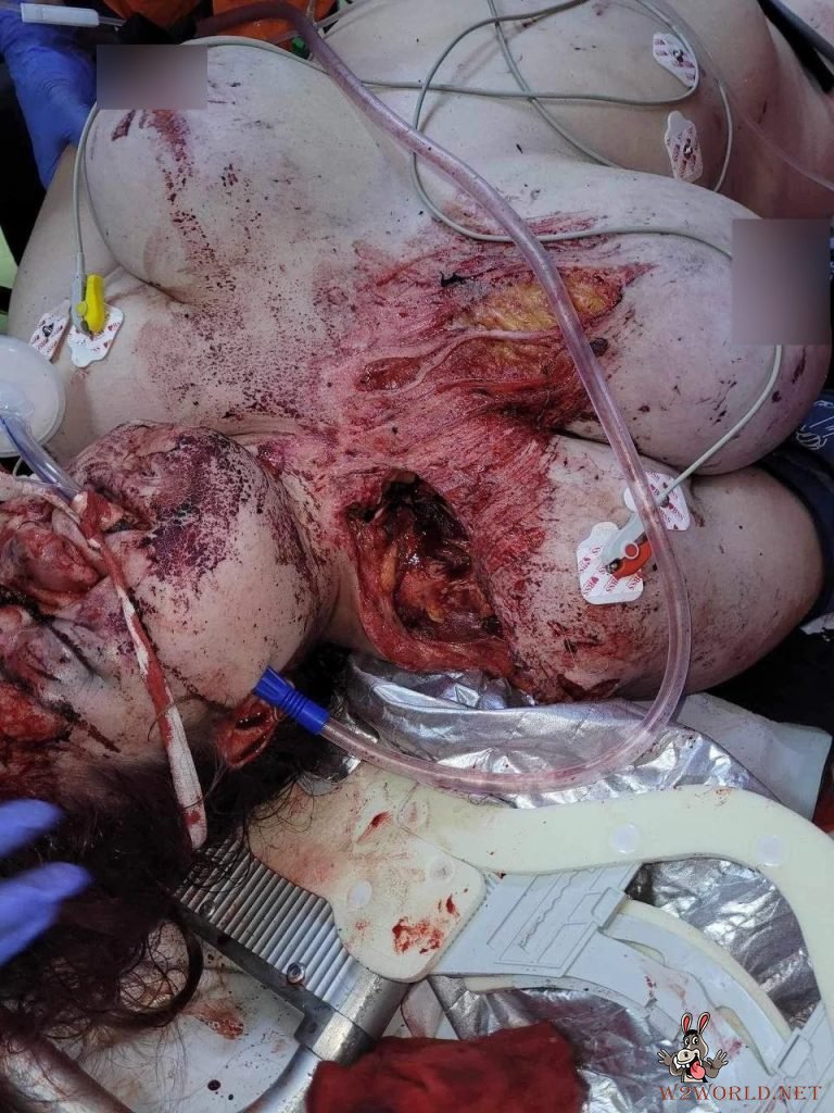 Young woman dying after accident
