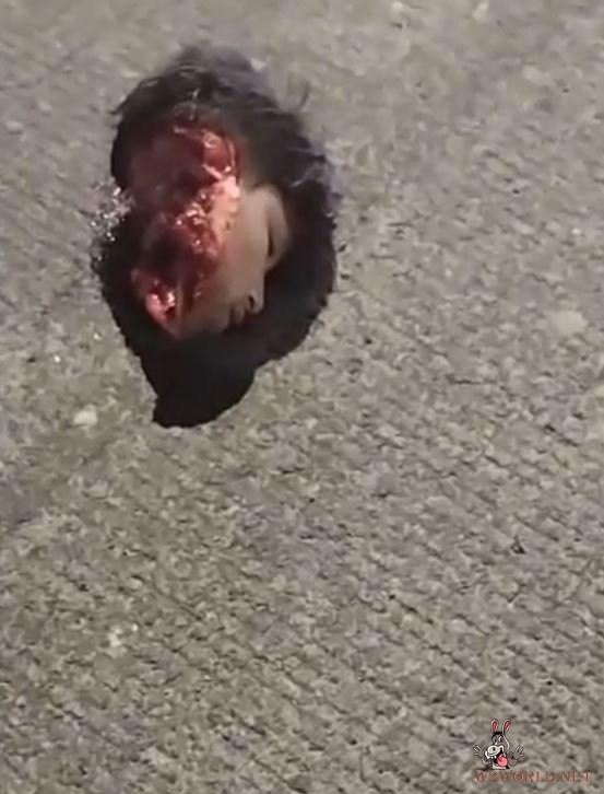 19-Year-Old Man Beheaded in Accident