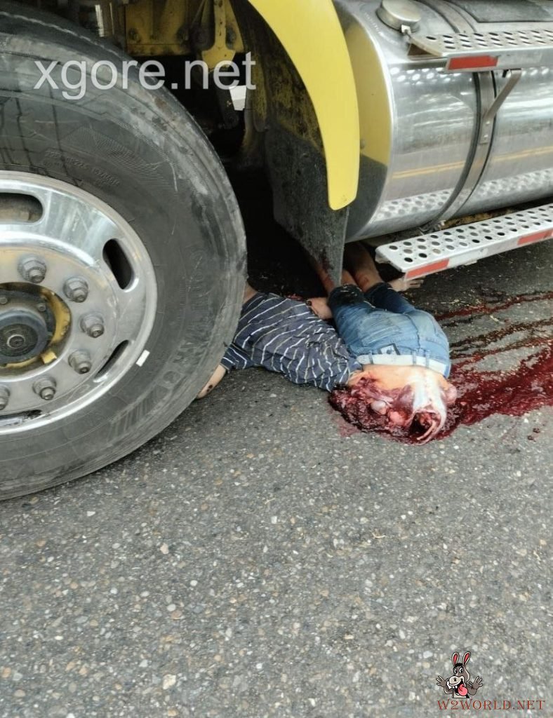 Colombia: Young Man Severed in Half in Horrific Truck Accident