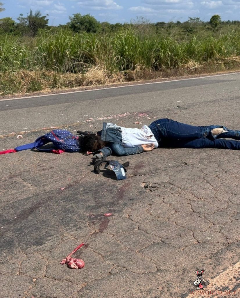 Truck crushes woman's head