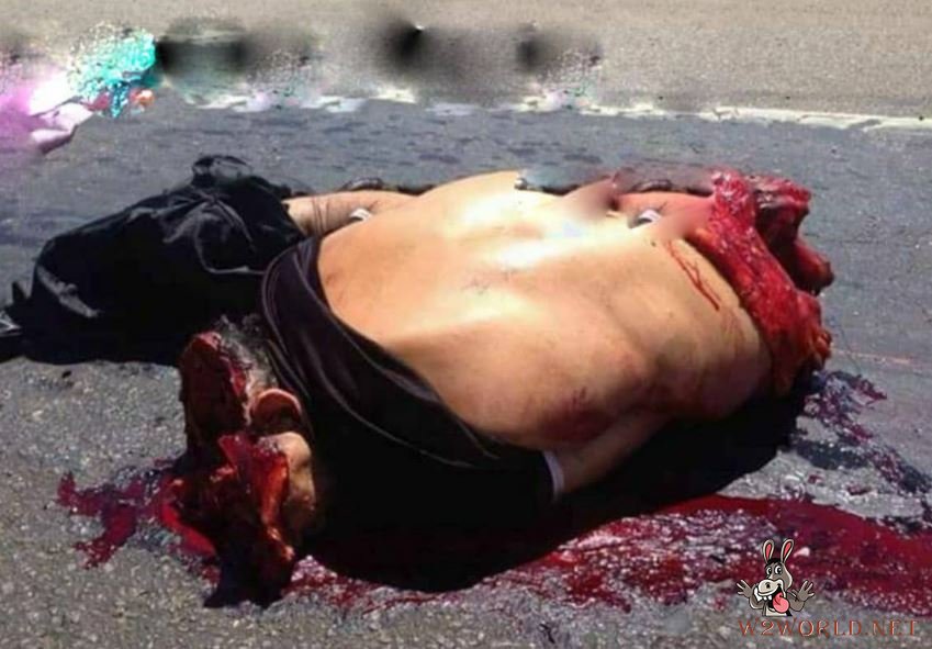 Man dismembered in accident