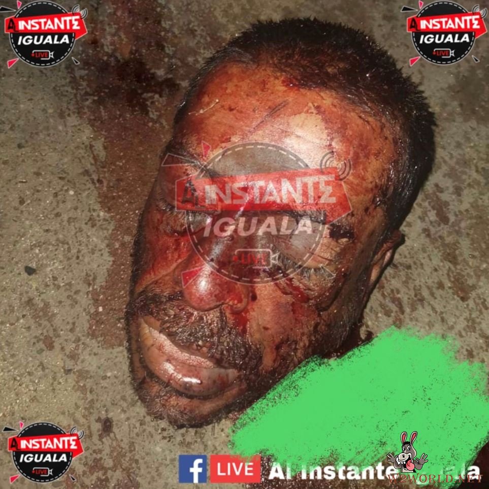 Photos of victims dismembered or beheaded in Mexico's gang wars