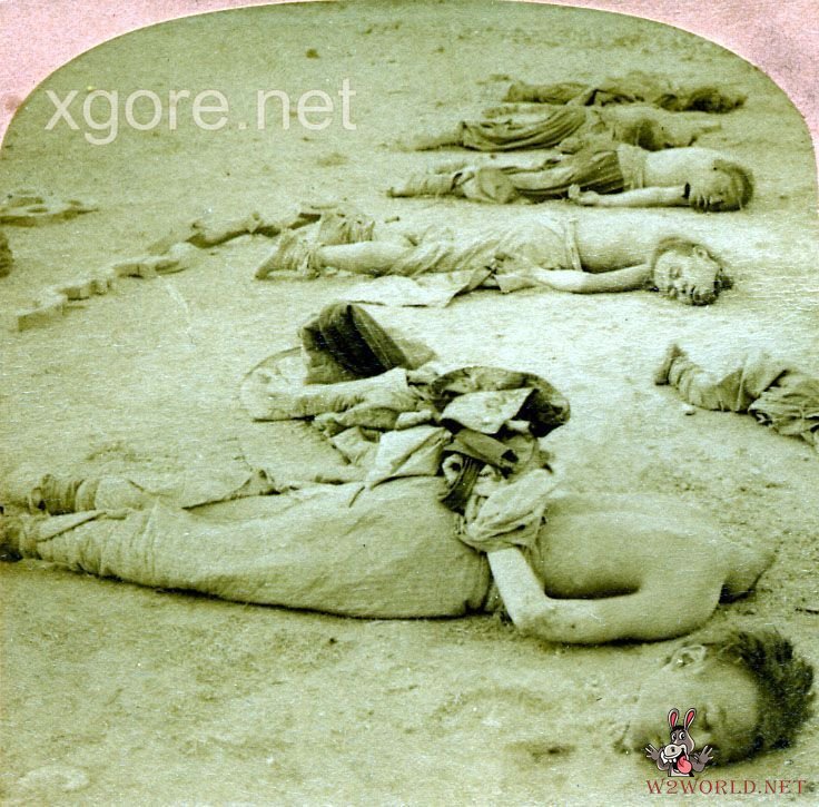 Classic Decapitation Cases: A Gruesome Examination