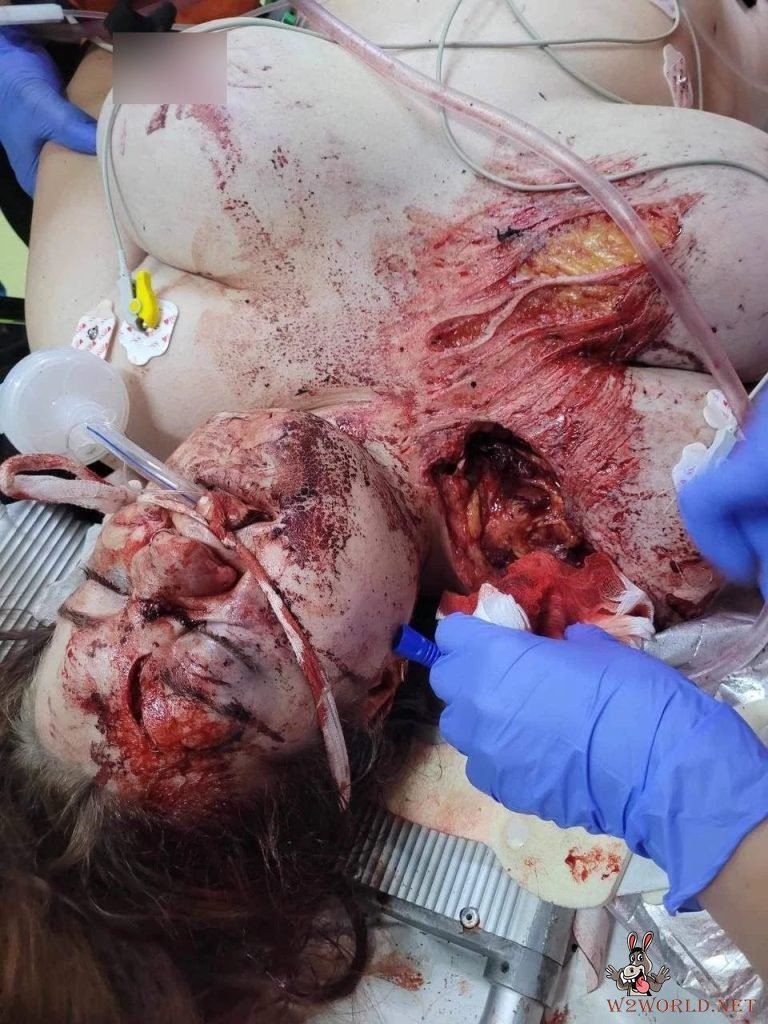Young woman dying after accident