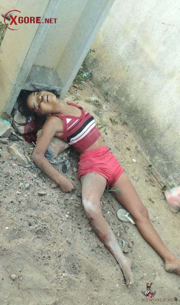 Graphic Photos Show Recent Women's Deaths and Suicides