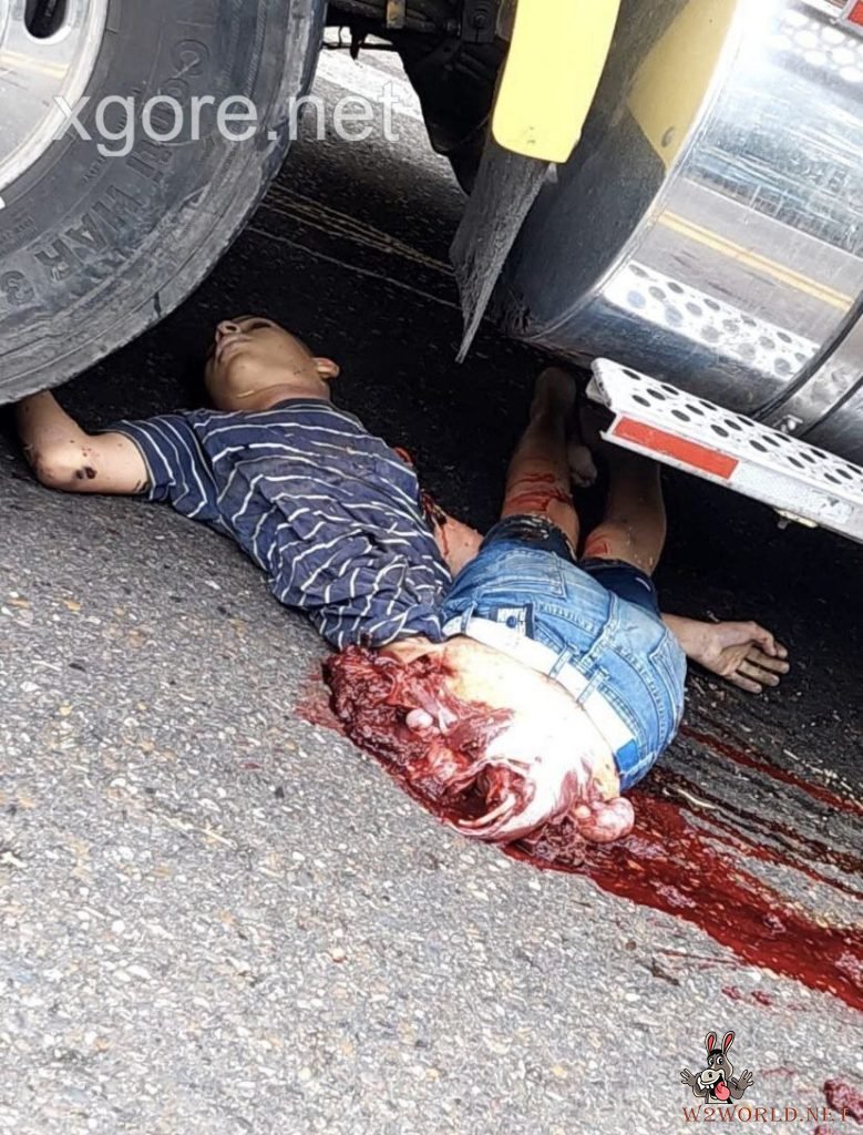 Colombia: Young Man Severed in Half in Horrific Truck Accident