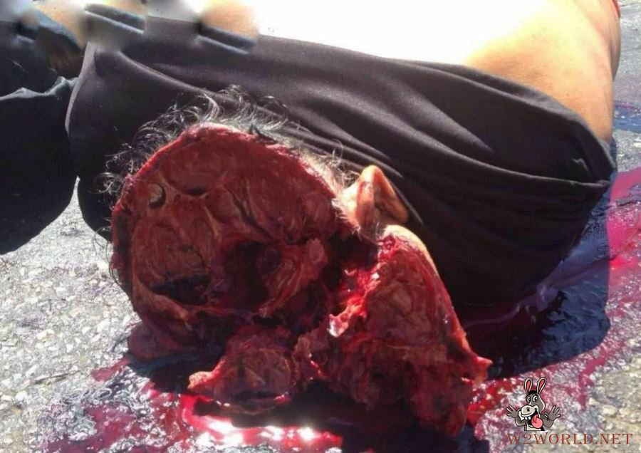 Man dismembered in accident