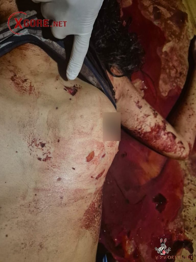 Young Woman Fatally Stabbed in Itaueira, Piauí, Brazil