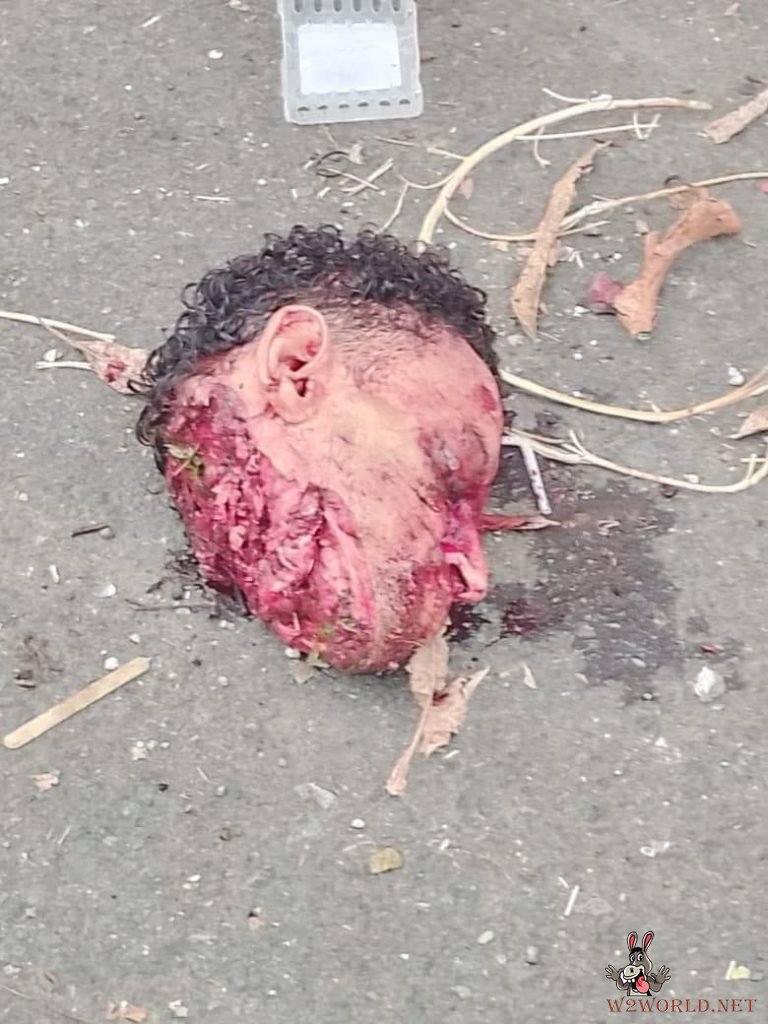 Discovery of severed head and body parts on road
