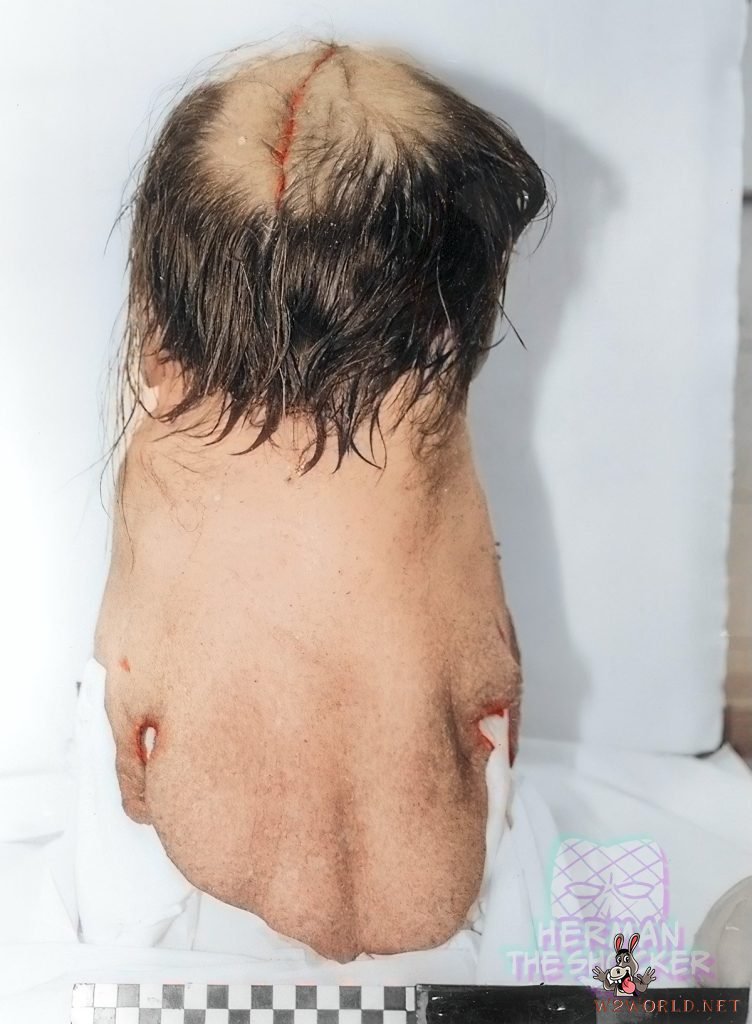 Son stabs father to death and skins his head