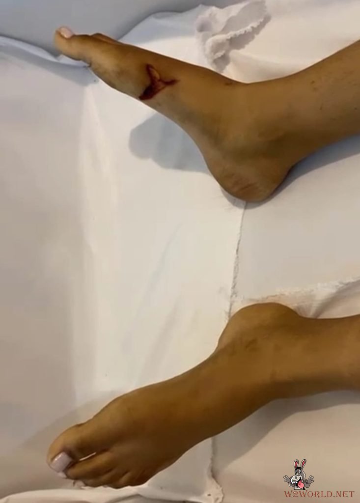18-Year-Old Girl Found Stabbed to Death by Lover