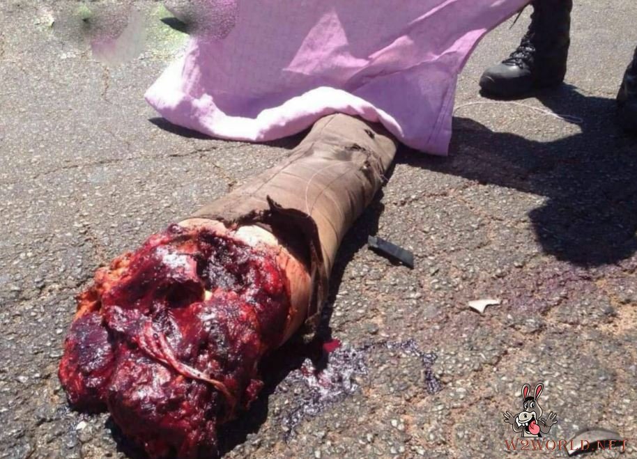 Man dismembered in accident