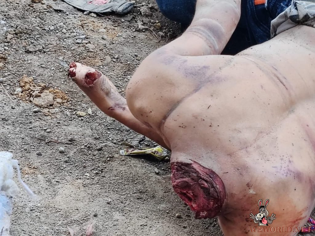 Man's Decapitated Body Found on Road in Guatemala