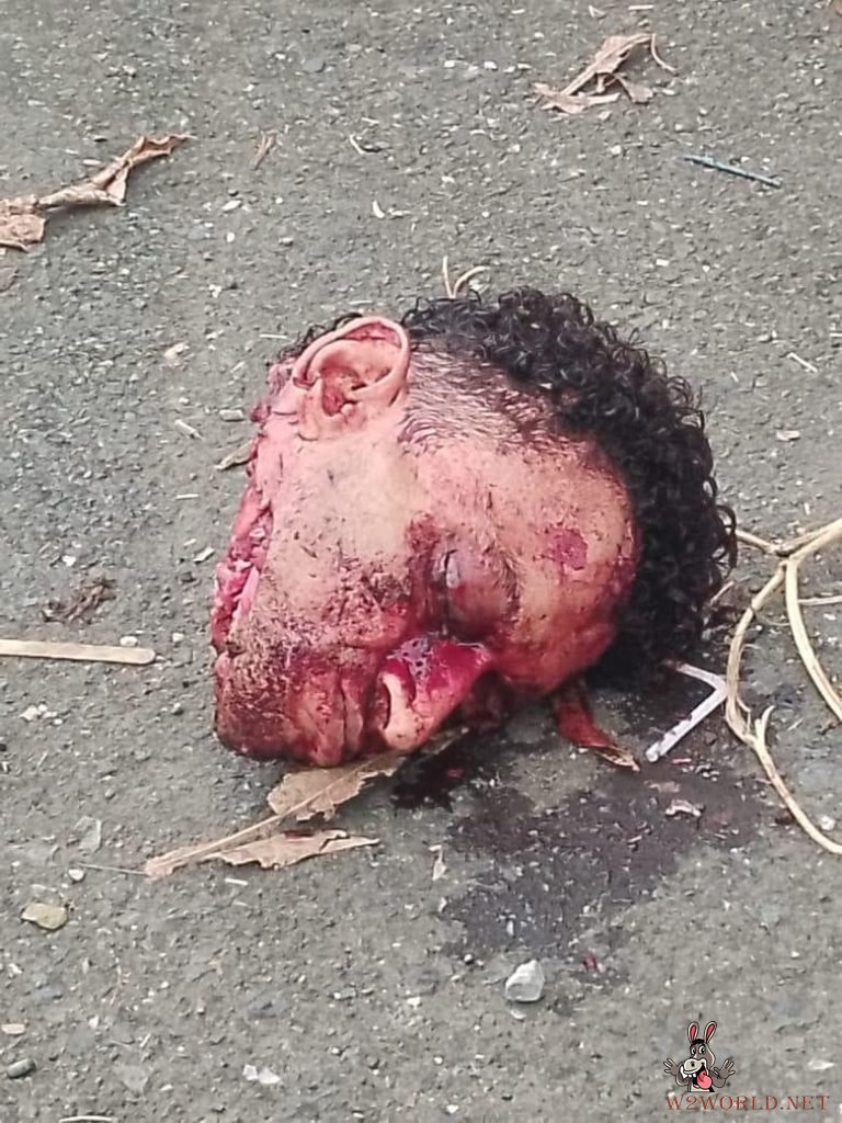 Discovery of severed head and body parts on road