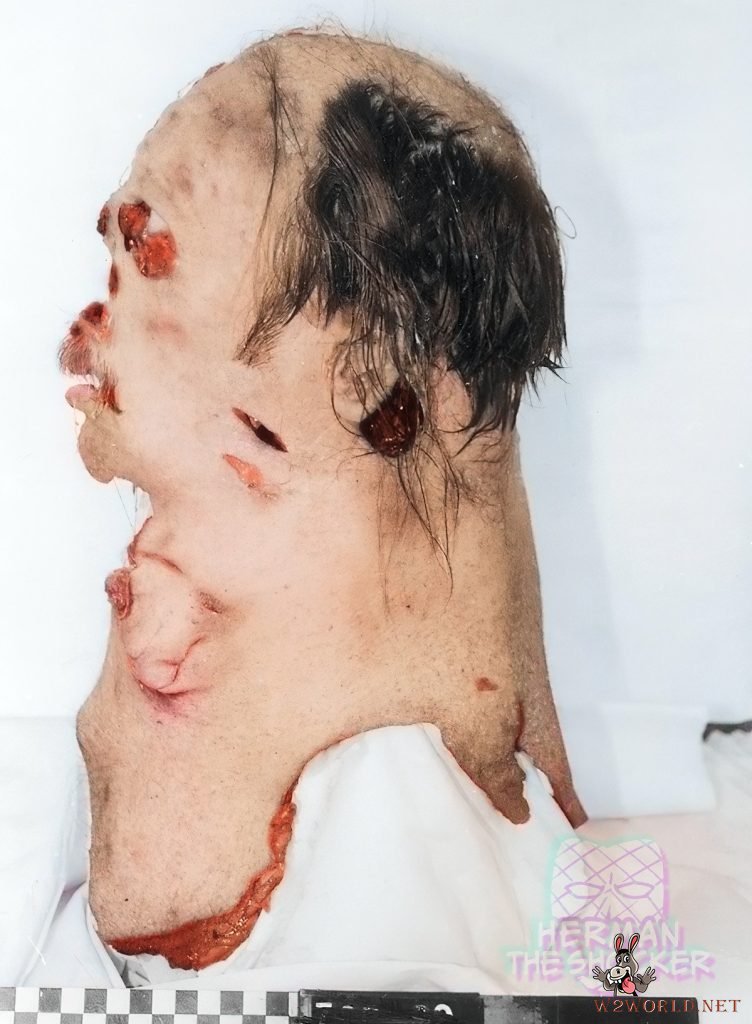 Son stabs father to death and skins his head