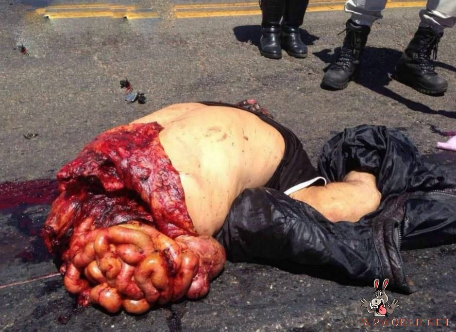 Man dismembered in accident