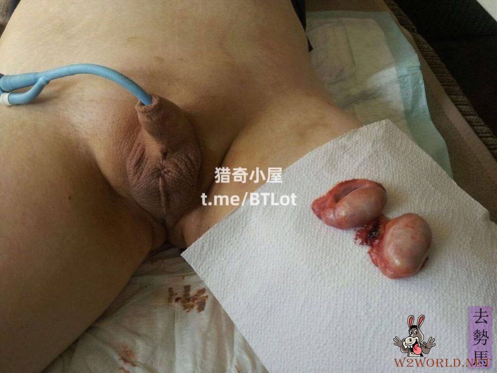 Penis Ruined in Photos
