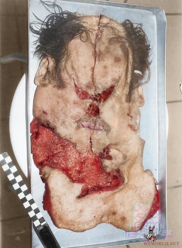 Son stabs father to death and skins his head