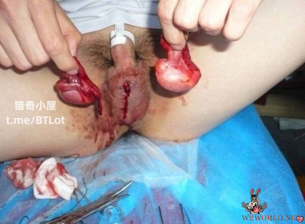 Penis Ruined in Photos