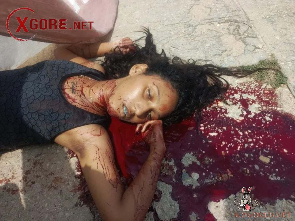 Graphic Photos Show Recent Women's Deaths and Suicides