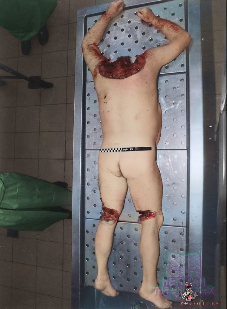 Son stabs father to death and skins his head