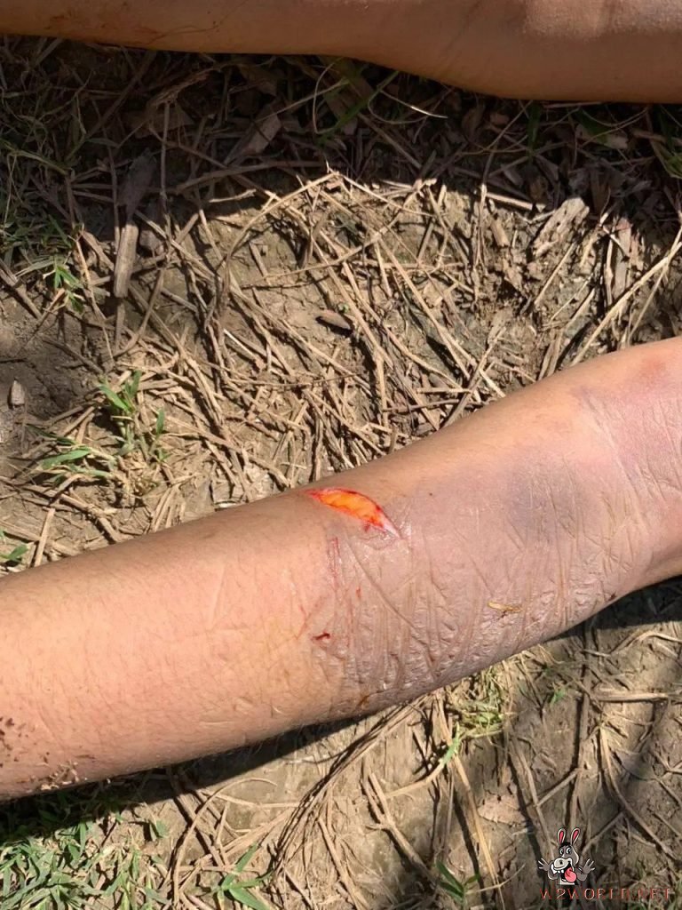 18-Year-Old Girl Found Stabbed to Death by Lover