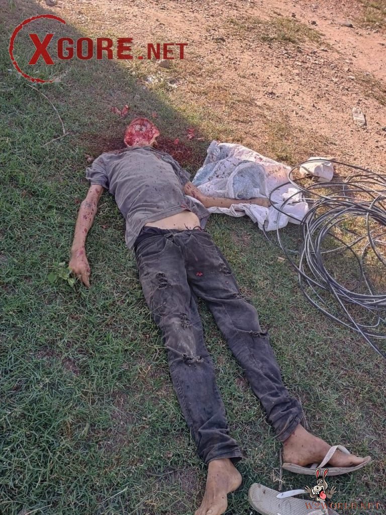 He suffered severe facial injuries