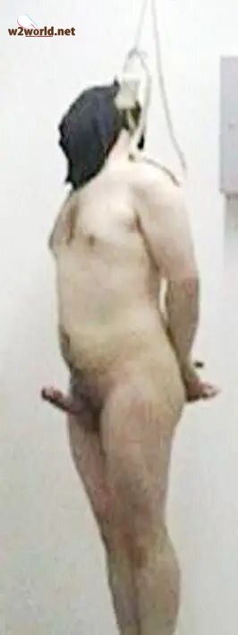 Nude male corpse died from various causes