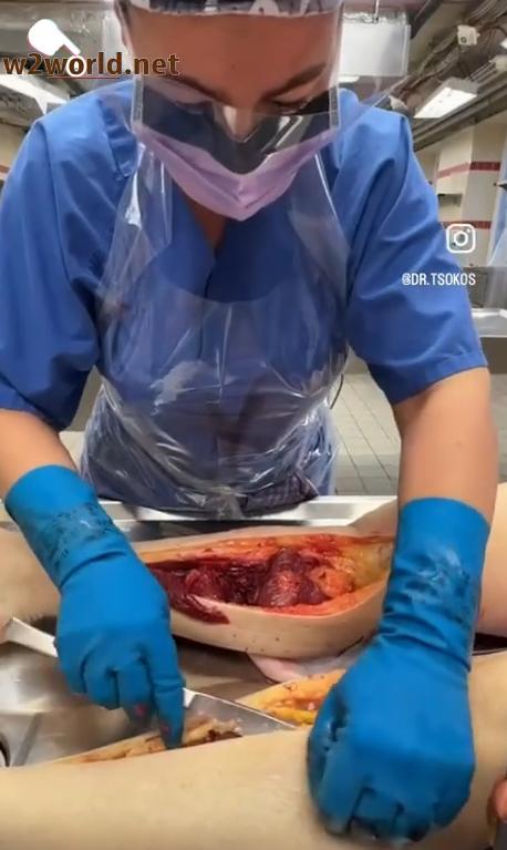 dissecting the lower calf of a corpse