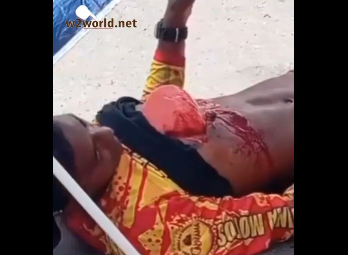 graphic accident video Brazil lung moving in chest