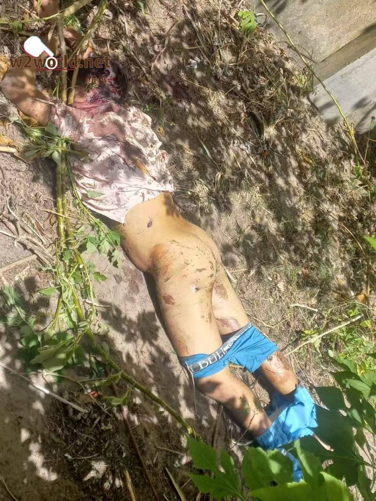 19-Year-Old Man Mauled to Death by Lions After Climbing Into Enclosure at Brazil Zoo-02