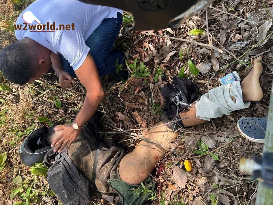 One Suffers Traumatic Leg Amputation 01