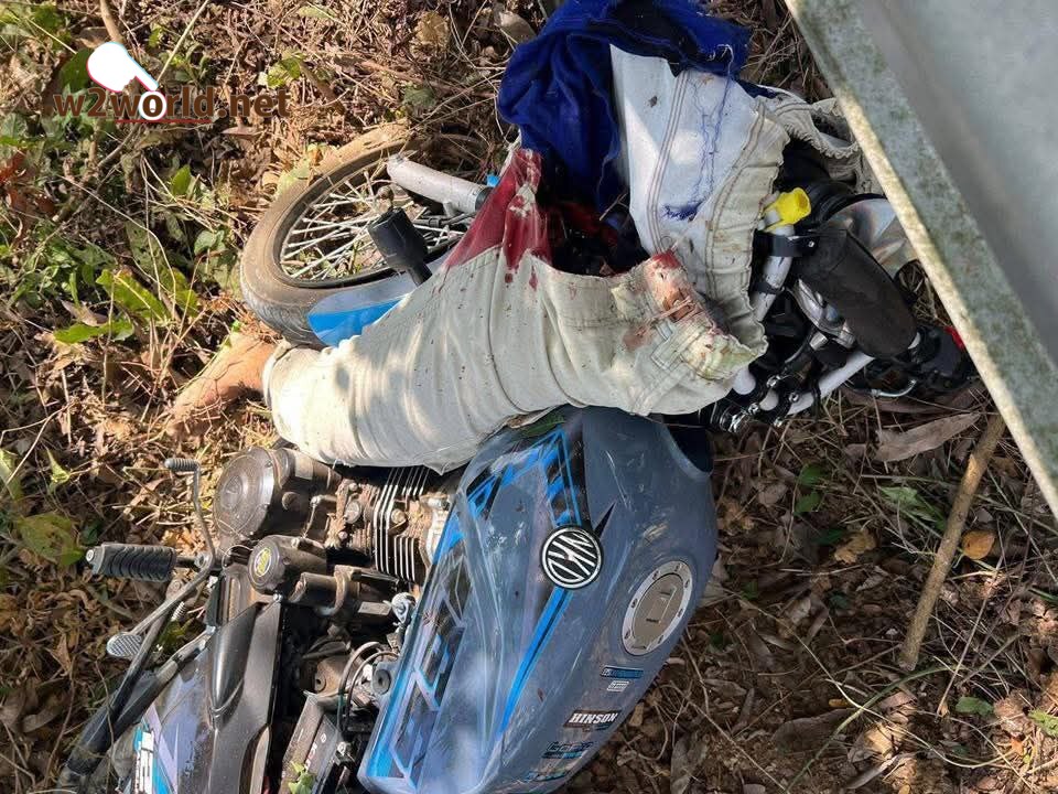 One Suffers Traumatic Leg Amputation 02