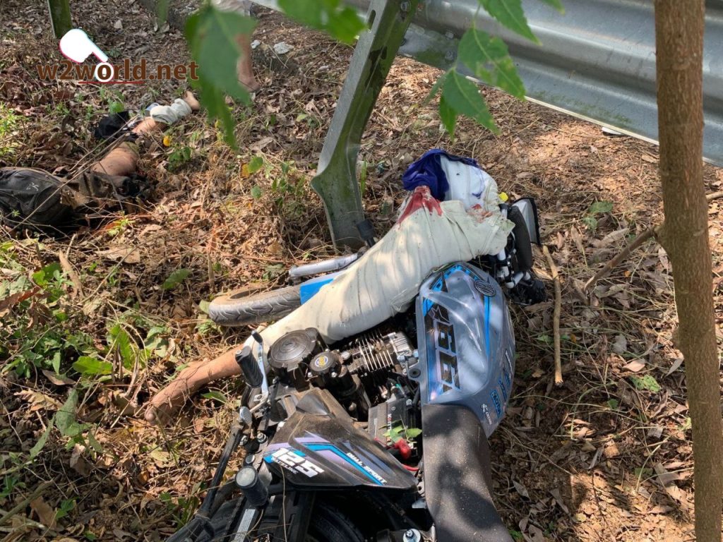 One Suffers Traumatic Leg Amputation 04