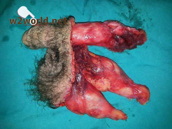 Compilation of cut off male penises 