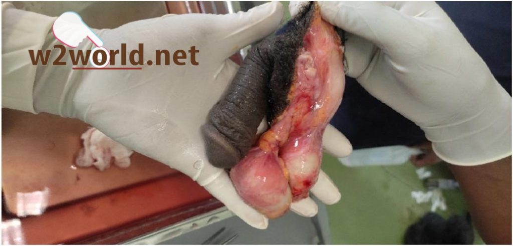 Compilation of cut off male penises  01