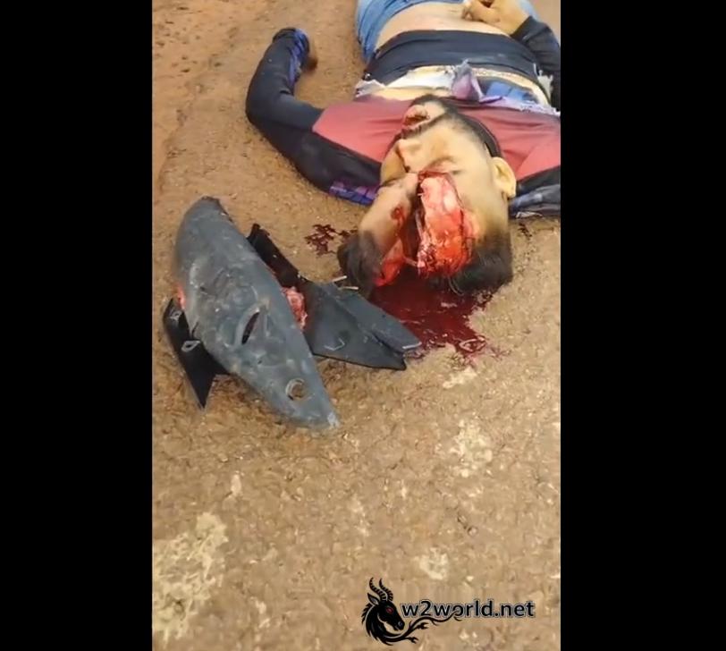 Gruesome Accident in Novo Bacabal, Maranhão: Man's Head Split Open, Brain Exposed