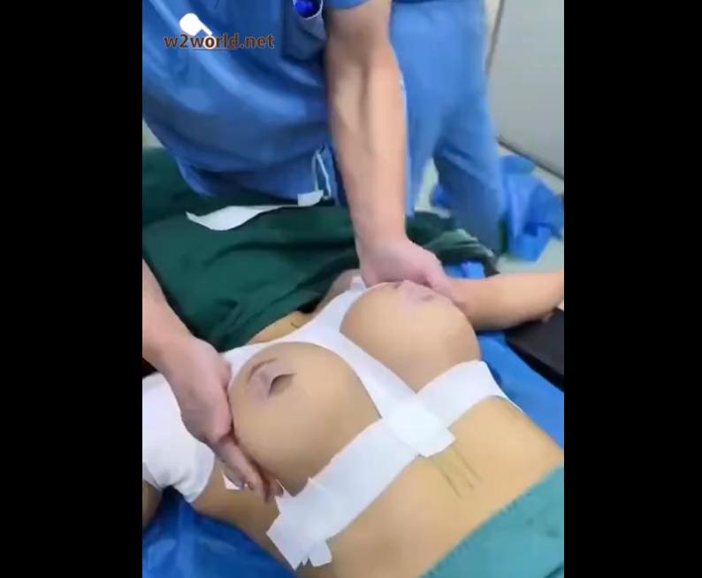 The doctor is trying on the new breasts of a woman who recently had breast augmentation surgery