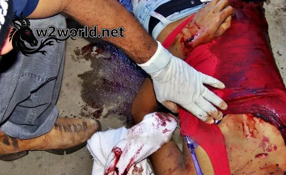 Husband Stabs Wife to Death After Toxic Breakup 05