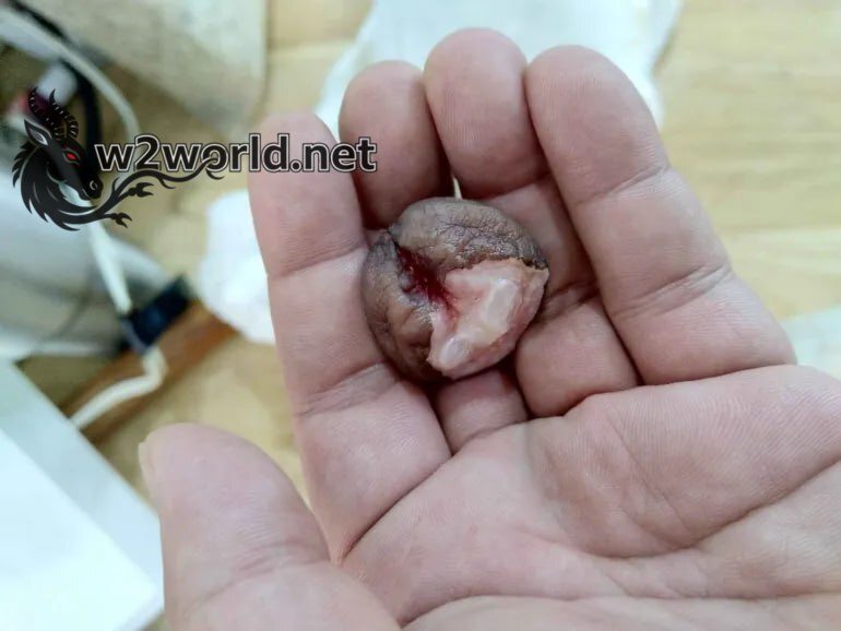 Penises are amputated because their owners no longer need them